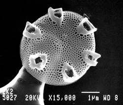 Magnified image of the new genus and species of diatoms, Livingstonia palatkaensis