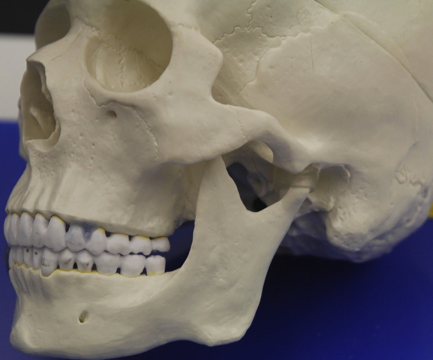 This is a model of the temporomandibular joint.