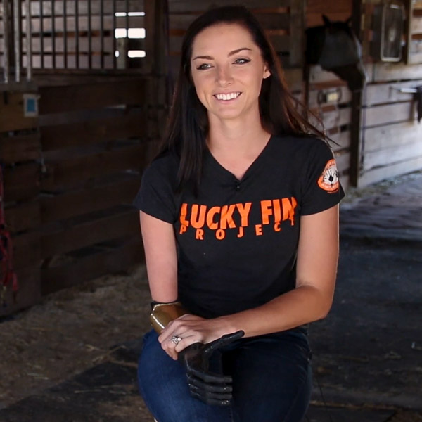 Ashley Sherman uses muscles in her partial right arm to control the bionic limb. "I love being a bionic woman."