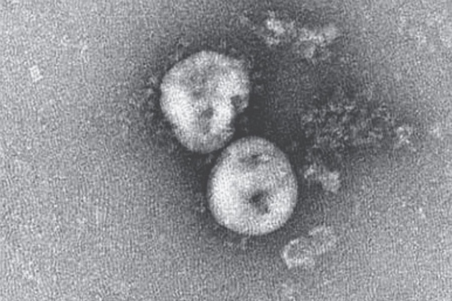 An image of the 2019 novel coronavirus (2019-nCoV) that caused an outbreak of respiratory illness first detected in Wuhan, China. Image credit: Zhu et al, doi: 10.1056/NEJMoa2001017.