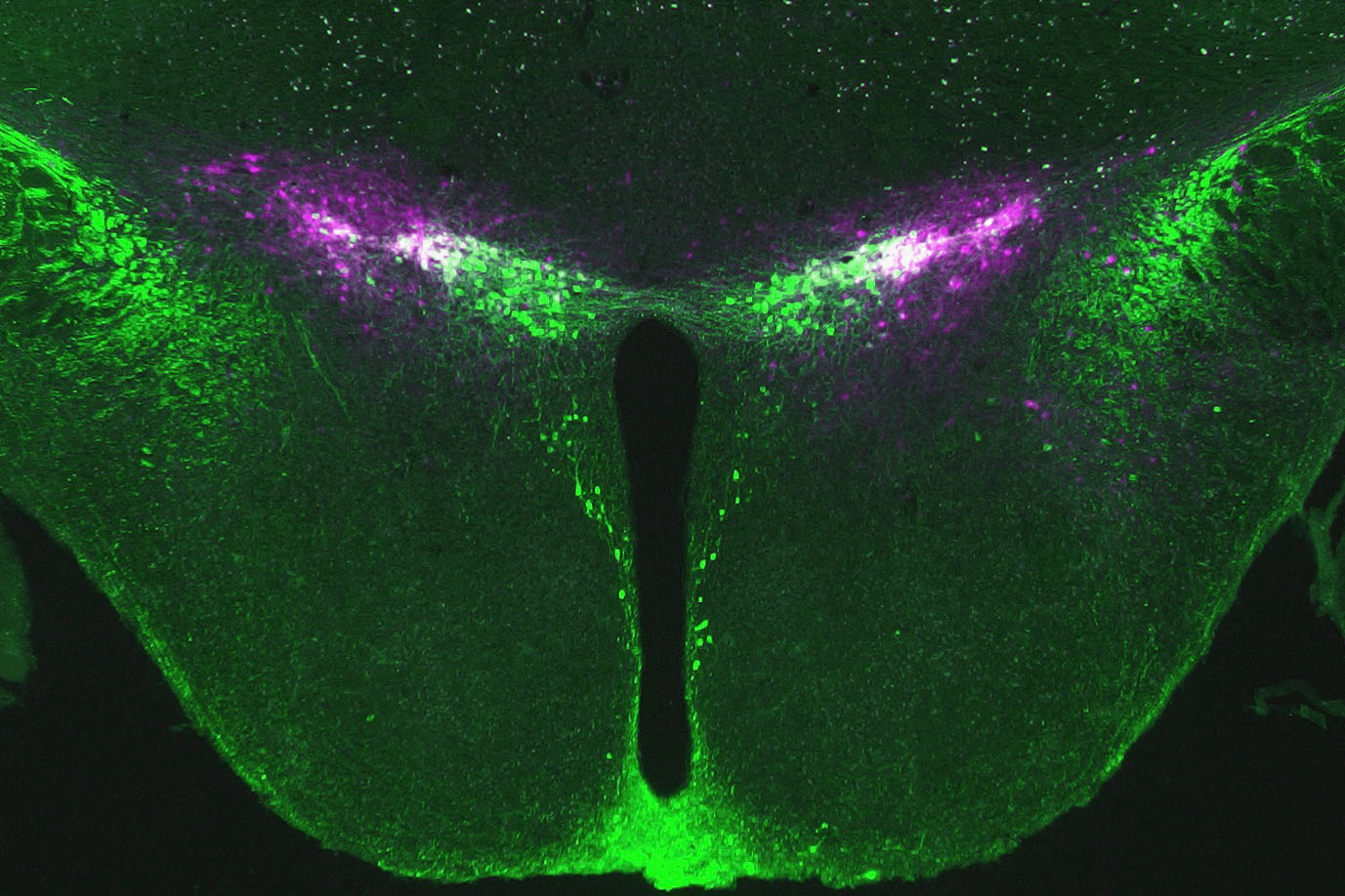 Study Sheds Light on How Dopamine Neurons Contribute to Memory