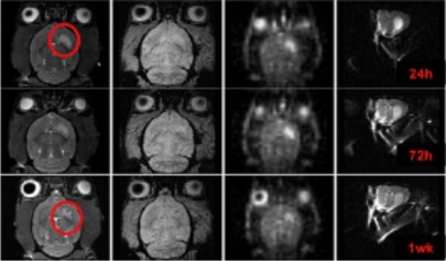 Scans from stroke research conducted at the National High Magnetic Field Laboratory.