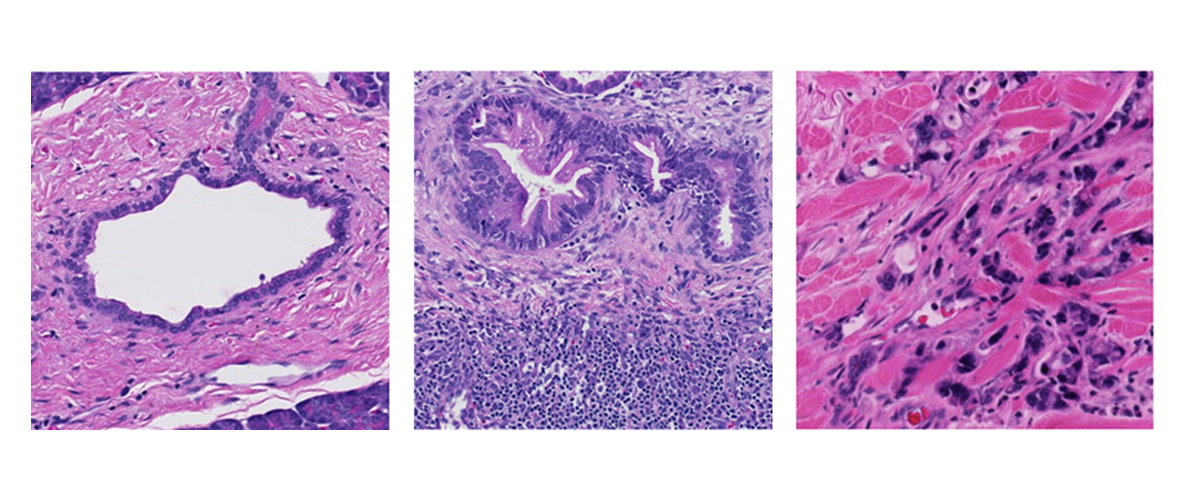Florida State University researchers will lead $2.8M study into how cell changes affect pancreatic cancer