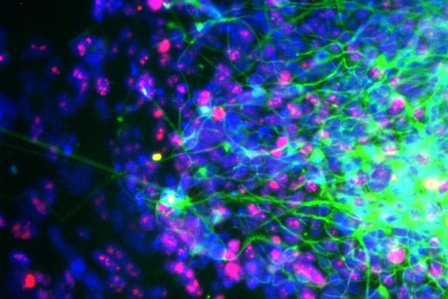 Microscopic image of a brain organoid showing a dense network of fluorescently labeled cells. Bright green branching structures extend across the image, particularly on the right, while numerous blue and magenta cell structures appear throughout against a dark background.