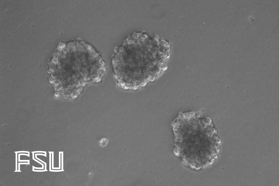 A grayscale image showing clusters of cells.